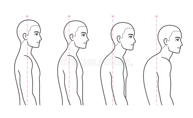 Diagram showing forward head posture caused by slouching, with neck carrying extra load.
