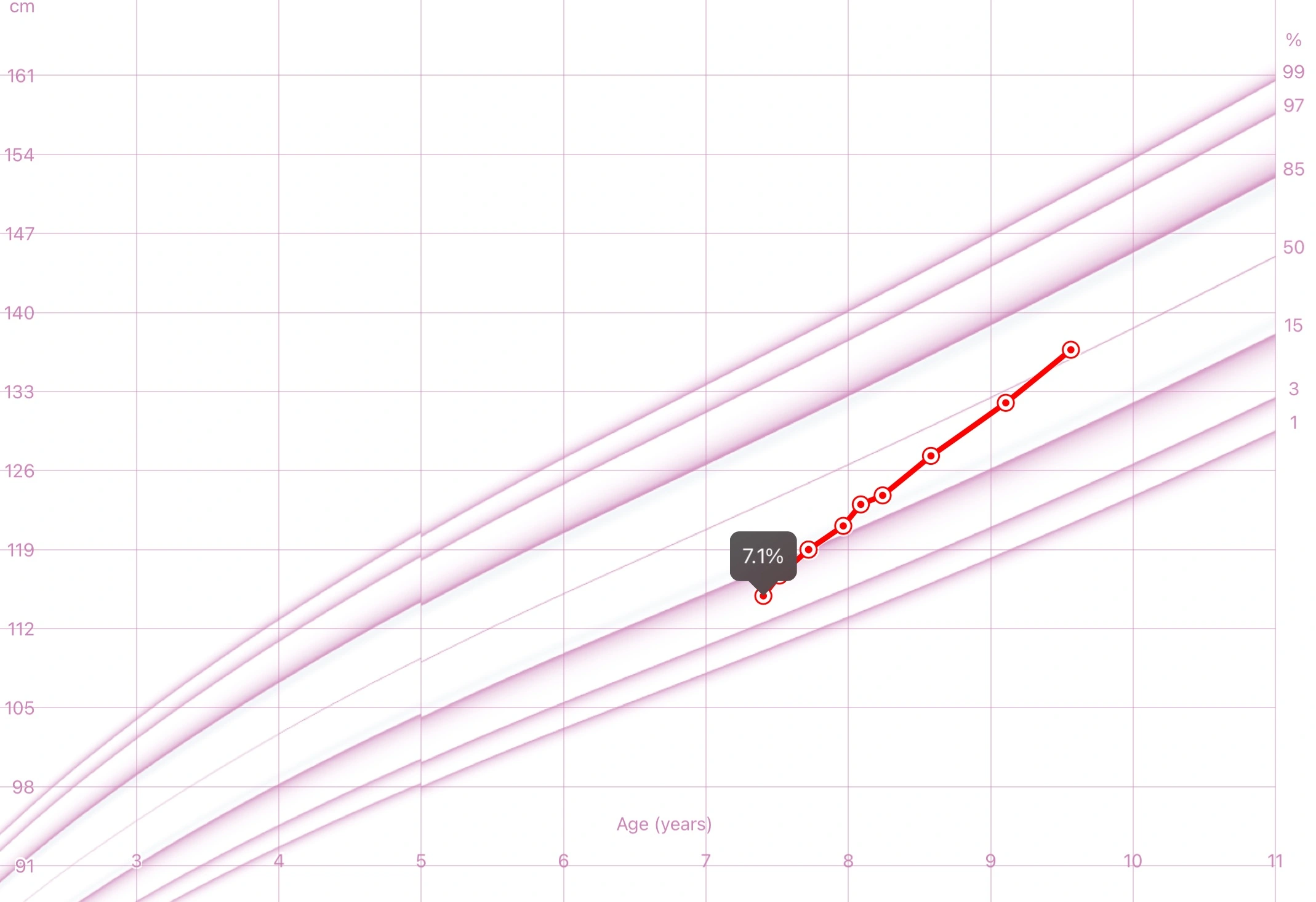 A pediatric growth chart showing steady height improvement during growth hormone therapy for a healthy child, monitored through regular follow-up and bone age assessments.
