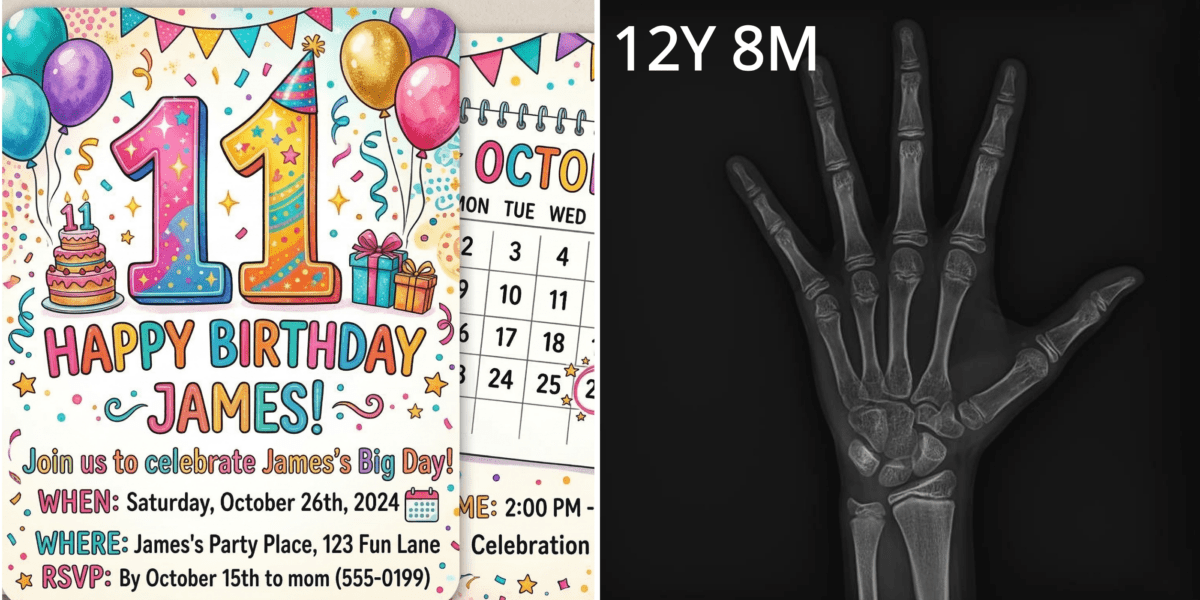 Side-by-side comparison of chronological age vs. bone age at I Grow Clinic, showing how skeletal maturity determines remaining height potential.