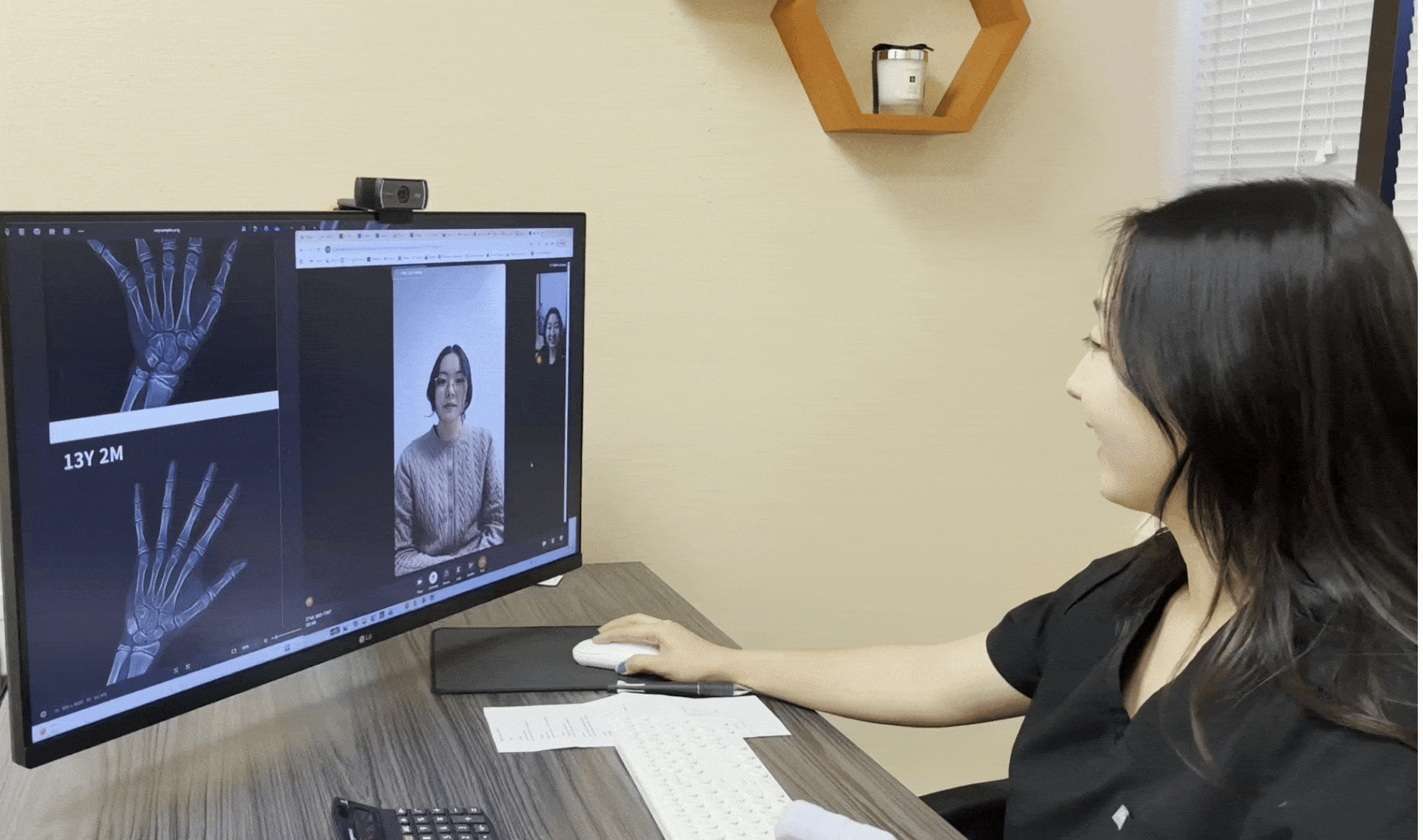 I Grow Clinic nurse practitioner conducting a pediatric growth hormone telehealth consultation with screen-shared bone age X-ray results for a child with idiopathic short stature
