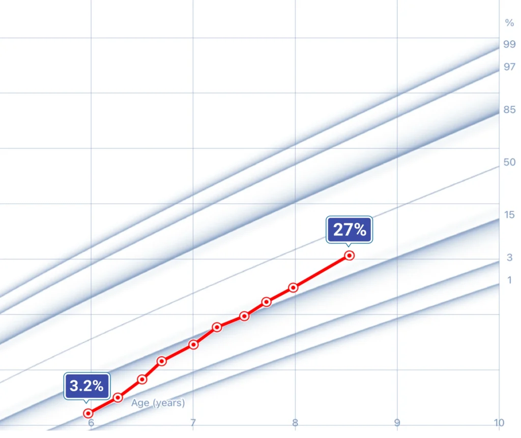 A real patient growth chart from I Grow Clinic showing measurable height gain during supervised growth hormone therapy, consistent with research showing an average adult height increase of 5 to 8 cm in children with idiopathic short stature.