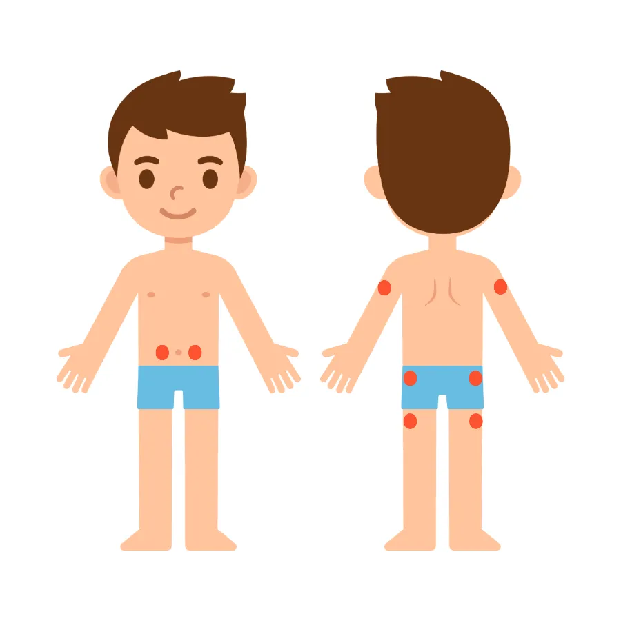 Guide to HGH injection sites in children showing arm, thigh, abdomen, and buttock zones
