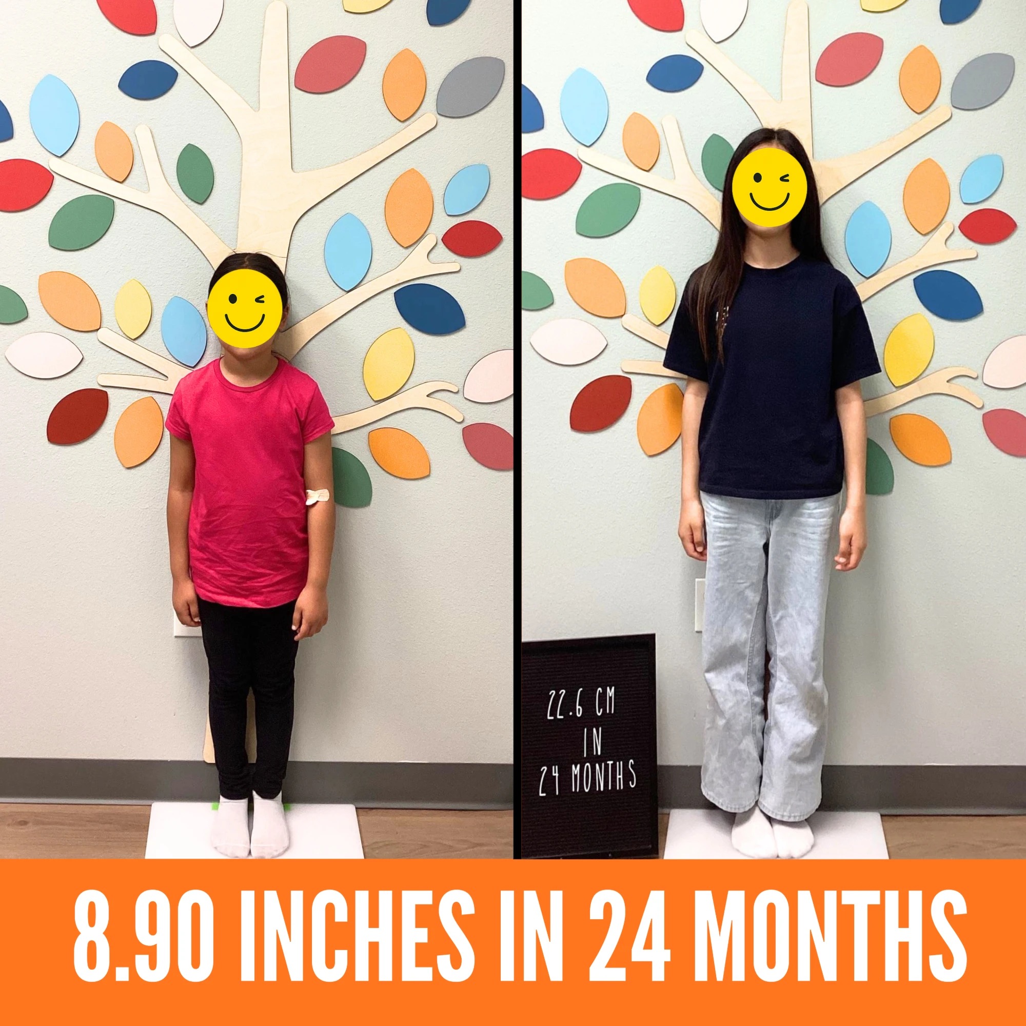Before and after photos of a girl who grew 8.90 inches in 24 months with care at I Grow Clinic