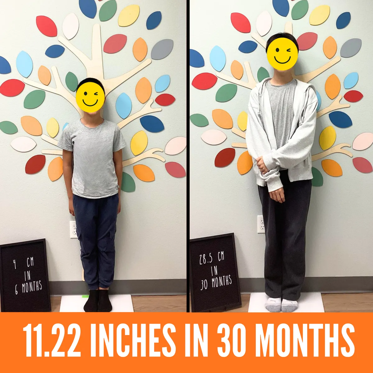 Before and after growth hormone treatment photos of a young patient at I Grow Clinic